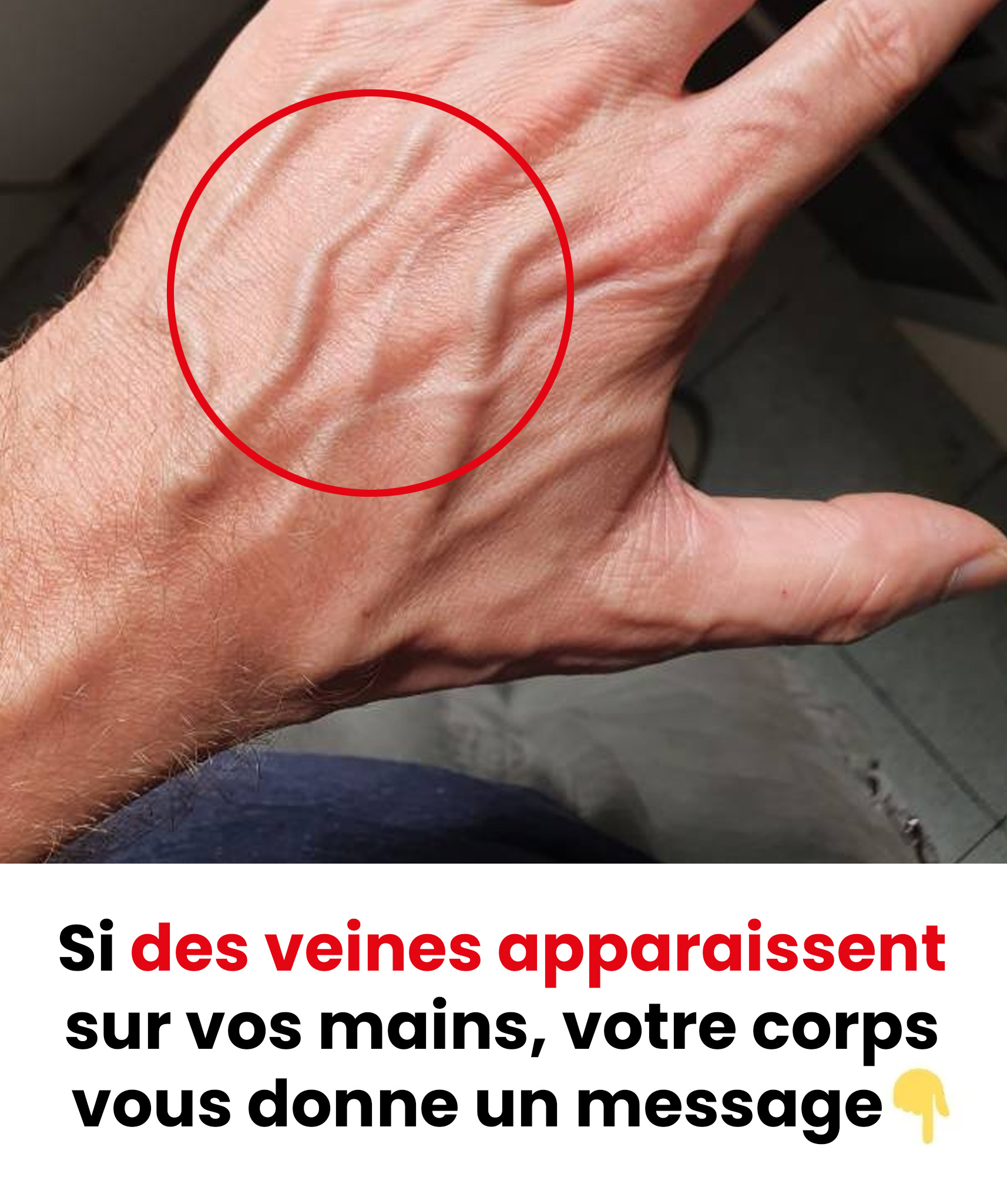 Veines apparentes soudaines : quand faut-il réellement s’inquiéter ?